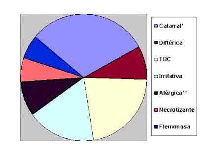 Tipos de laringitis